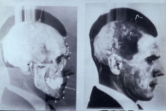 La segunda muerte de Josef Mengele, el médico nazi que se ocultó en Brasil