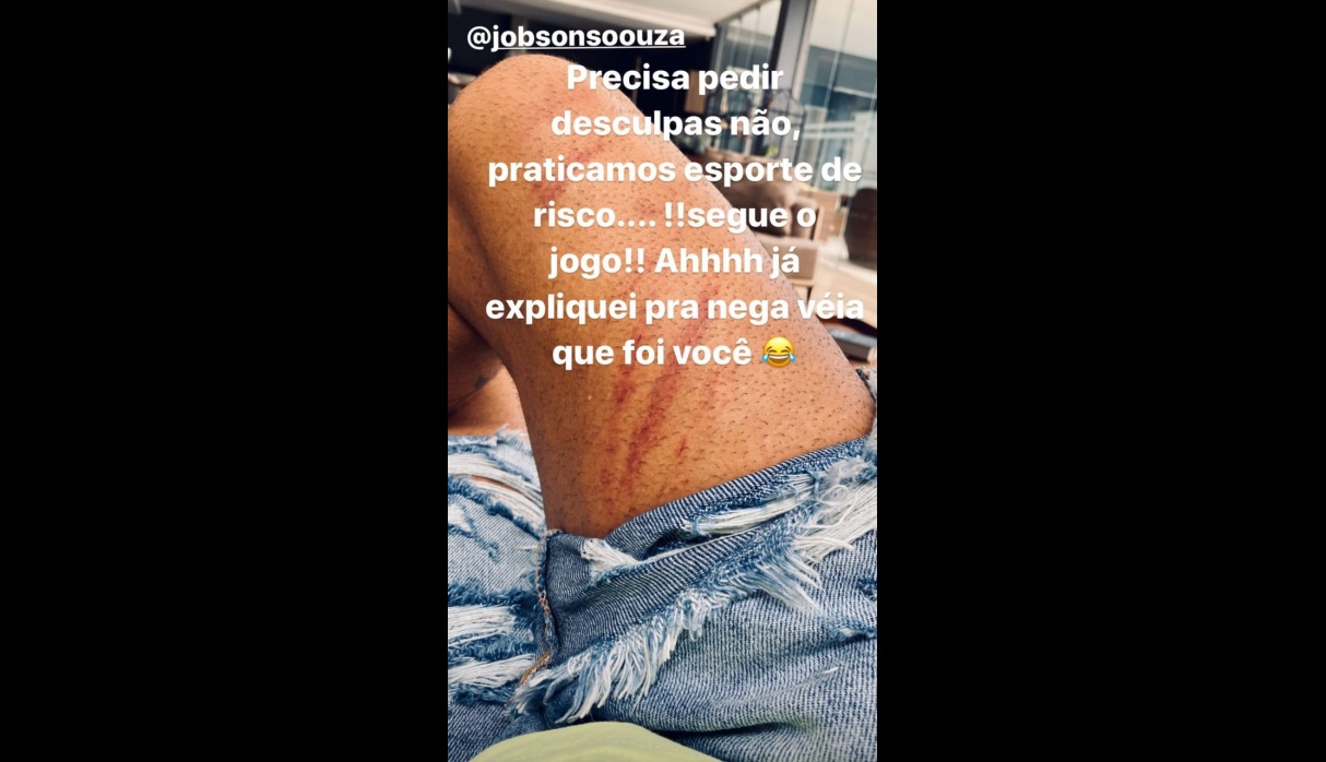 Dani Alvesrecibió terrible falta en Brasil y se disculparon con él por Instagram