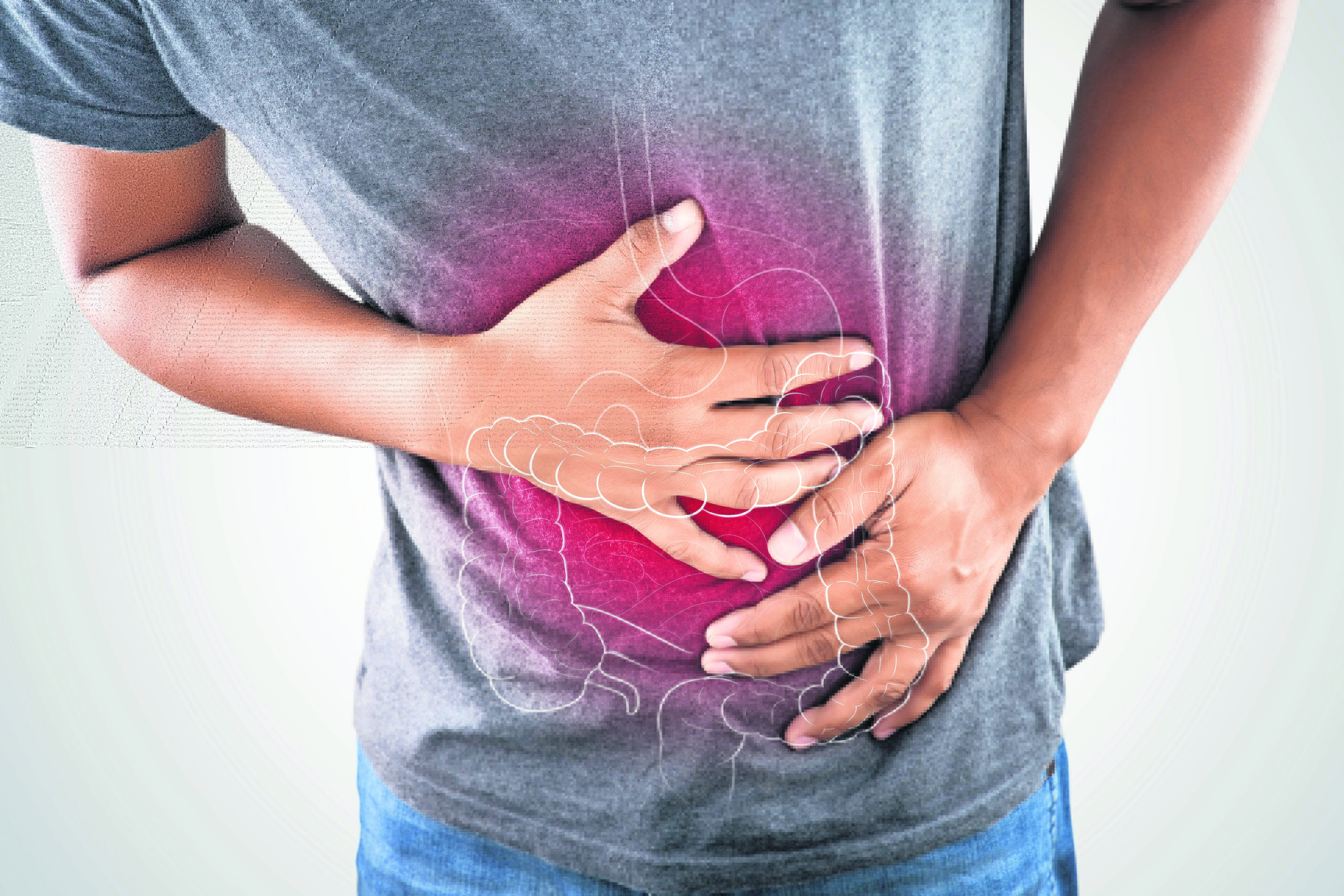 Verdades sobre el cáncer de colon - El Comercio - Perú