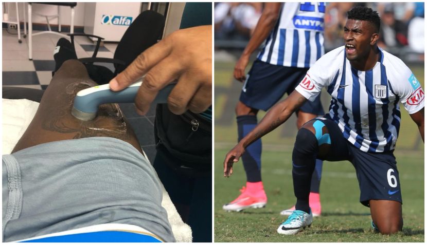 Alianza Lima: ¿Carlos Ascues llegará al partido contra Boca Juniors?