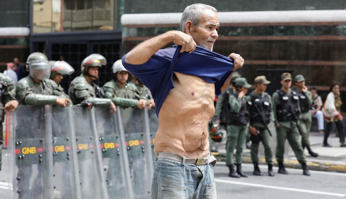 Un ex trabajador petrolero de Exxon Mobil que lleva 21 días en huelga de hambre, según su testimonio, muestra su abdomen durante un plantón de ex empleados. (Foto: EFE)